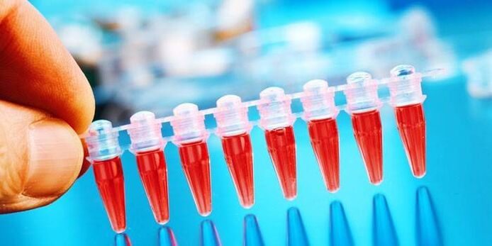 Krvni test za dijagnosticiranje prisutnosti parazita u crijevima