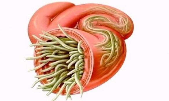 crvi u ljudskom crijevu