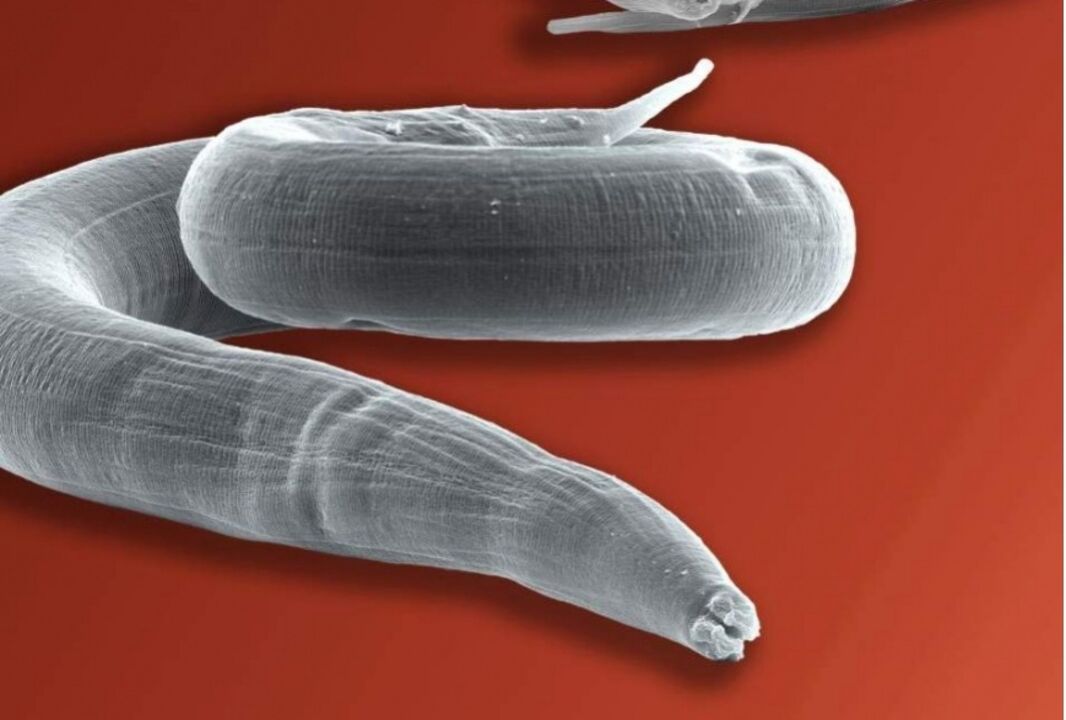 pinworm iz ljudskog tijela
