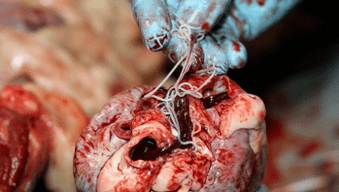 Helminths u srcu